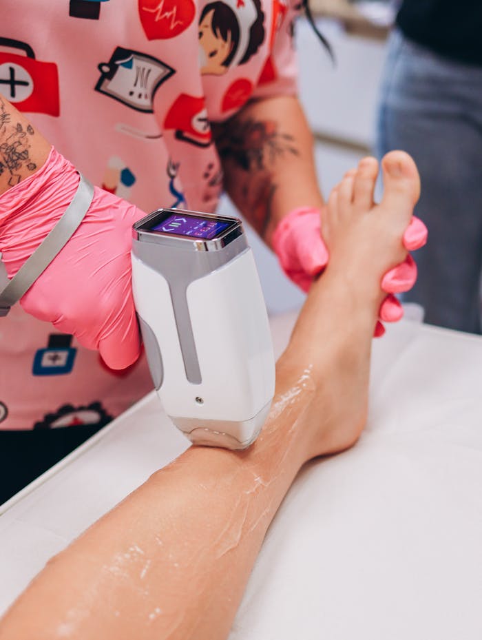 Close-up of a laser hair removal session on a person's leg in a modern clinic.